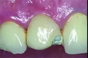 1581911840827520.jpg 2.jpg