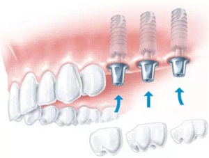 1601972332245238.jpg 微信图片_202010061023241.jpg